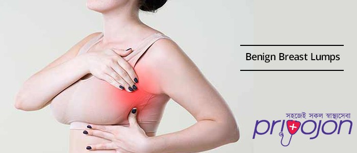 breast-lumps-treatment-procedure-cost-and-side-effects