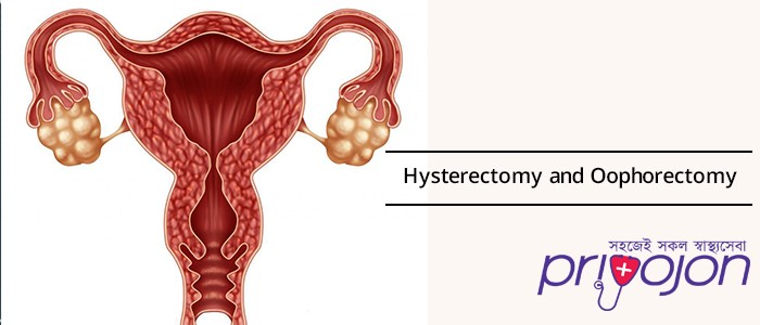 hysterectomy-treatment-procedure-and-side-effects