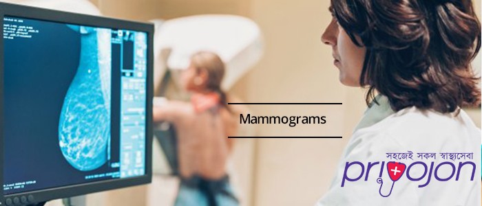 mammography-treatment-procedure-cost-and-side-effects