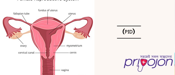 pid-symptom-treatment-and-causes