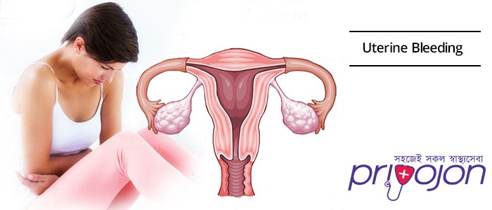 uterine-bleeding-treatment-procedure-cost-and-side-effects