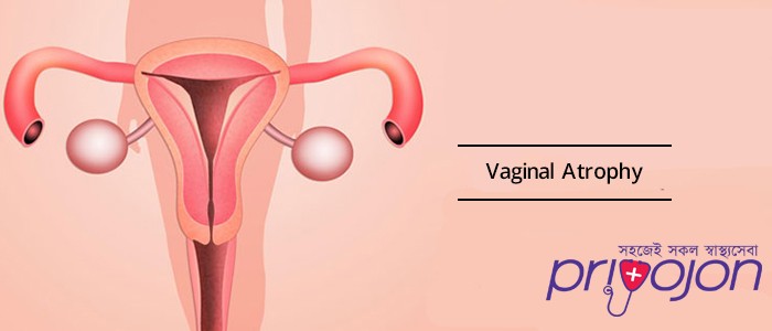 vaginalvulvar-atrophy-treatment-procedure-cost-and-side-effects