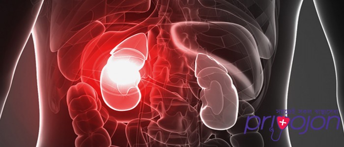 kidney-failure-treatment-procedure-cost-and-side-effects