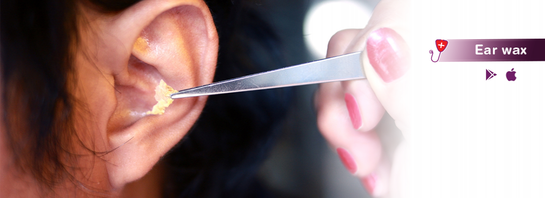ear-wax-treatment-procedure-cost-and-side-effectts