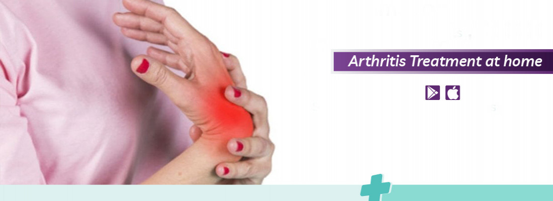 arthritis-treatment-at-home